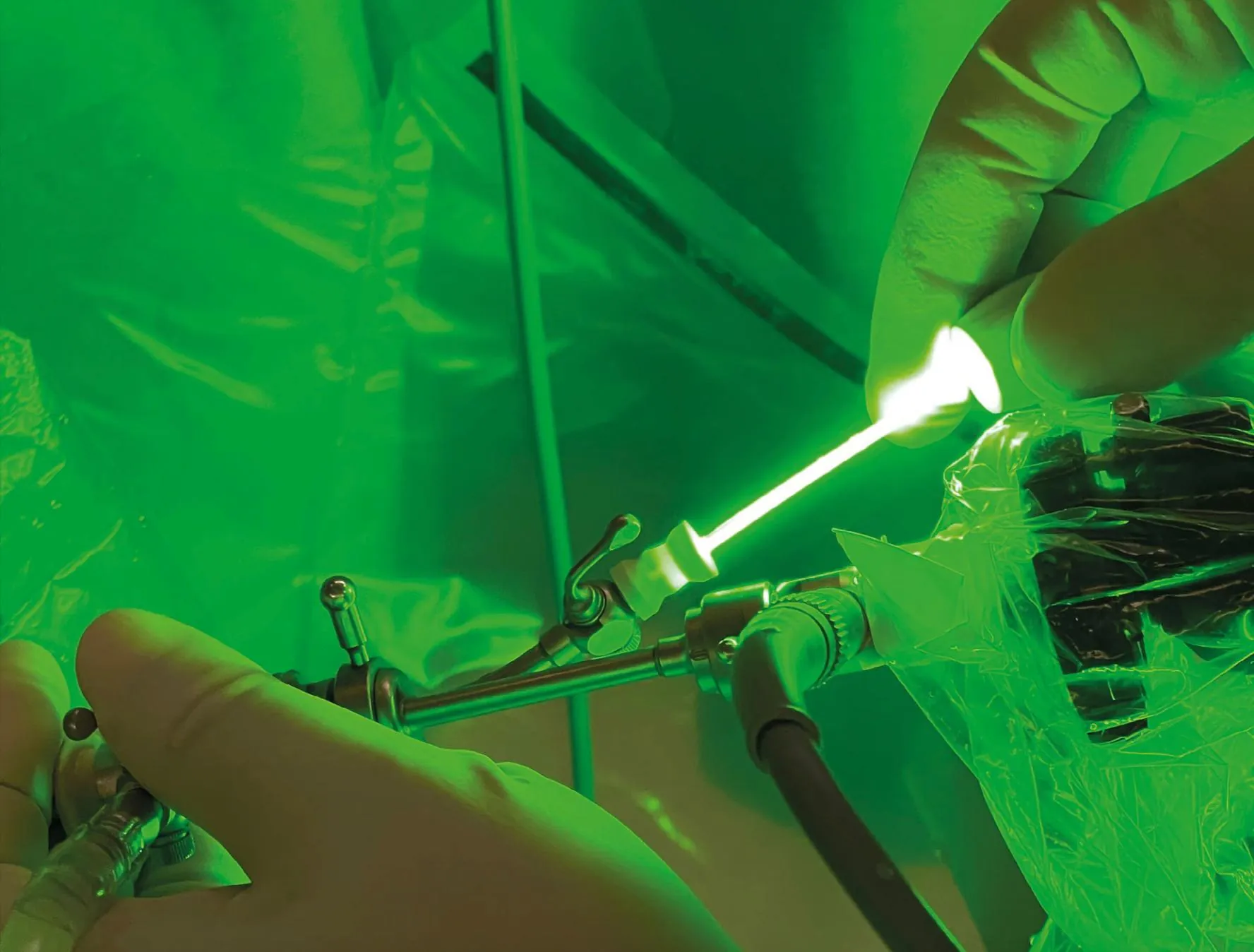 Vaporização de próstata com laser verde